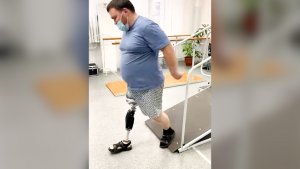 Учится ходить на протезе ноги с микропроцессором