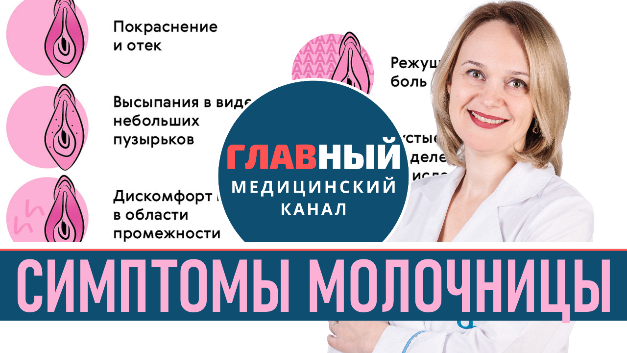 Молочница - симптомы и причины у женщин. Как выглядит молочница (фото 1-4). Кандидоз смотреть онлайн