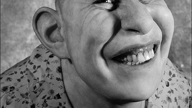 5 Ужасных Человеческих Мутаций смотреть онлайн