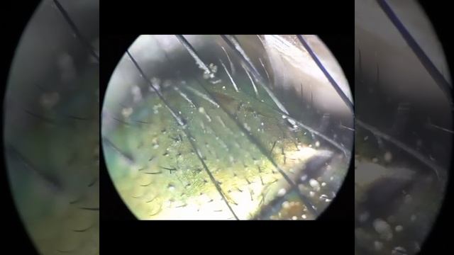 Зелёная муха: Назойливое насекомое | Интересные факты про муху смотреть онлайн