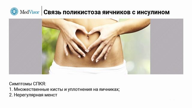 Симптомы поликистоза яичников и его связь с инсулином смотреть онлайн
