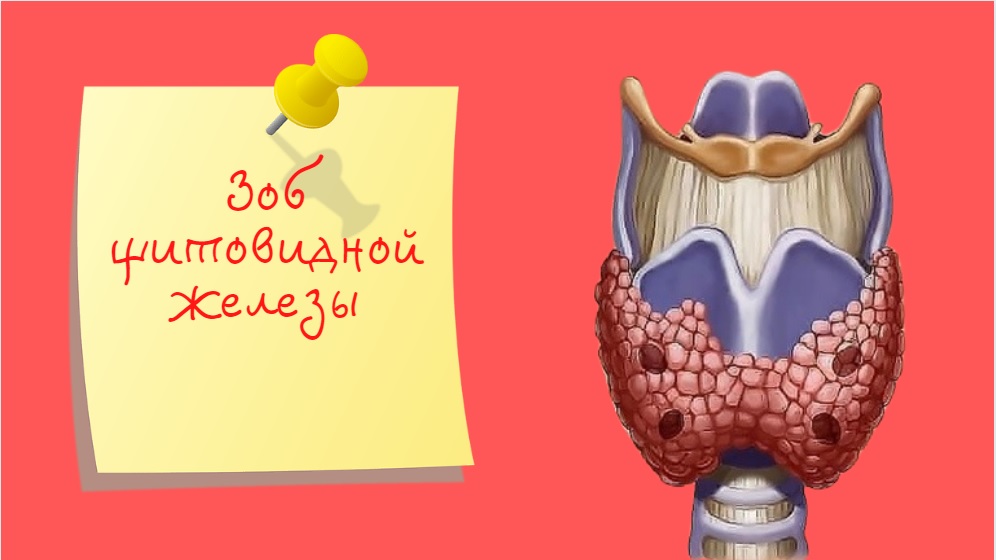 Зоб щитовидной железы | Симптомы заболевания