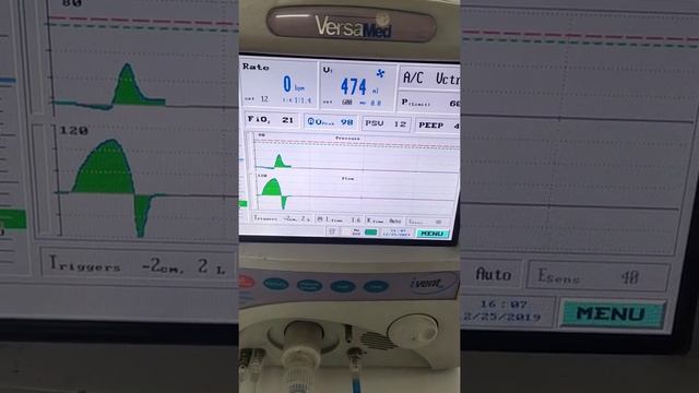 I Vent 201 Versamed compatible ventilator circuit смотреть онлайн