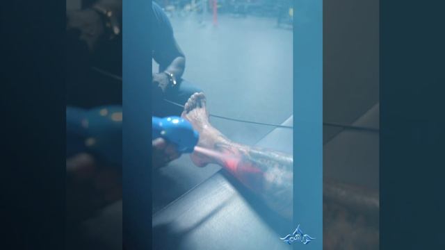 High Ankle Sprain Relieved With 2min Of Targeted Cryotherapy W/ ATL CHILL ?  @atlchill_
