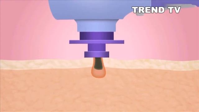 Купить Вакуумный очиститель пор для лица. смотреть онлайн