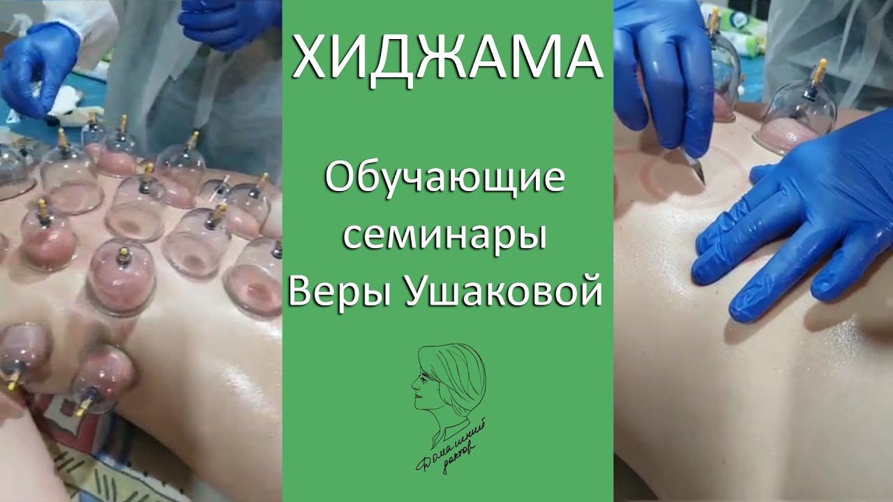 Хиджама. Обучающие семинары Веры Ушаковой смотреть онлайн