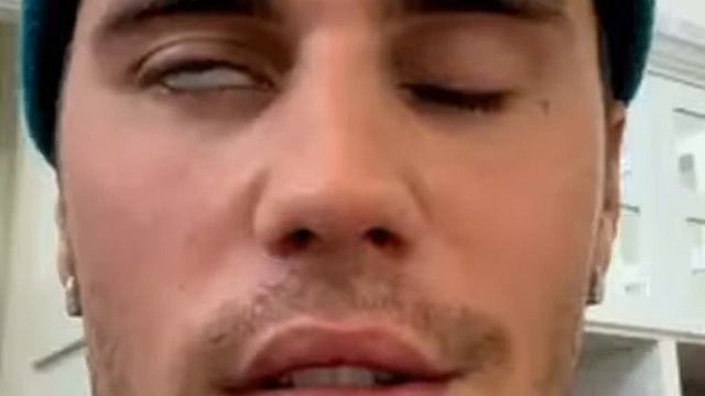 У Джастина Бибера паралич лицевого нерва смотреть онлайн