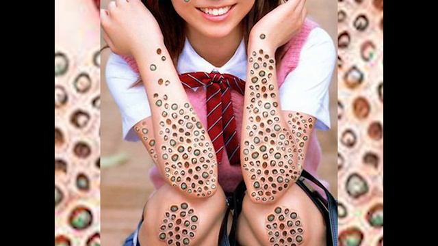 Трипофобия