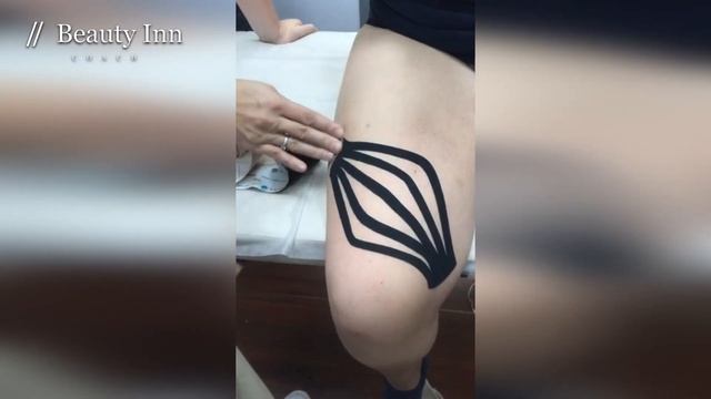 ТЕЙПИРОВАНИЕ. АППЛИКАЦИЯ НА ЗОНУ НАД КОЛЕНОМ