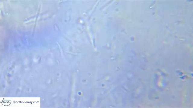 dental plaque dentaire MicrobeScope orthodontiste Sherbrooke H смотреть онлайн
