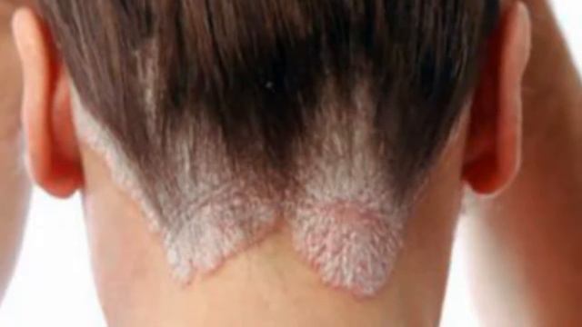 Lipoma xaqida ✿❀ Липома хақида смотреть онлайн
