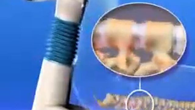 Массажёр Для Лечения Болей В Пояснице "Домашний Лекарь" смотреть онлайн