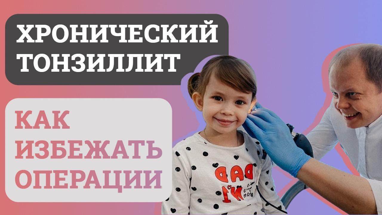 Хронический ТОНЗИЛЛИТ, ЭФФЕКТИВНОЕ лечение. БЕЗ ОПЕРАЦИИ. смотреть онлайн