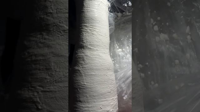 Лечение трофической язвы. Наложение цинк-желатиновой повязки по методу А.П.Войтенко смотреть онлайн