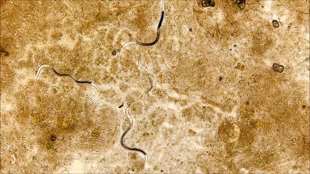 КТО ЖИВЕТ ПОД НОГТЯМИ? ГРЯЗЬ И ГЛИСТЫ ПОД НОГТЯМИ