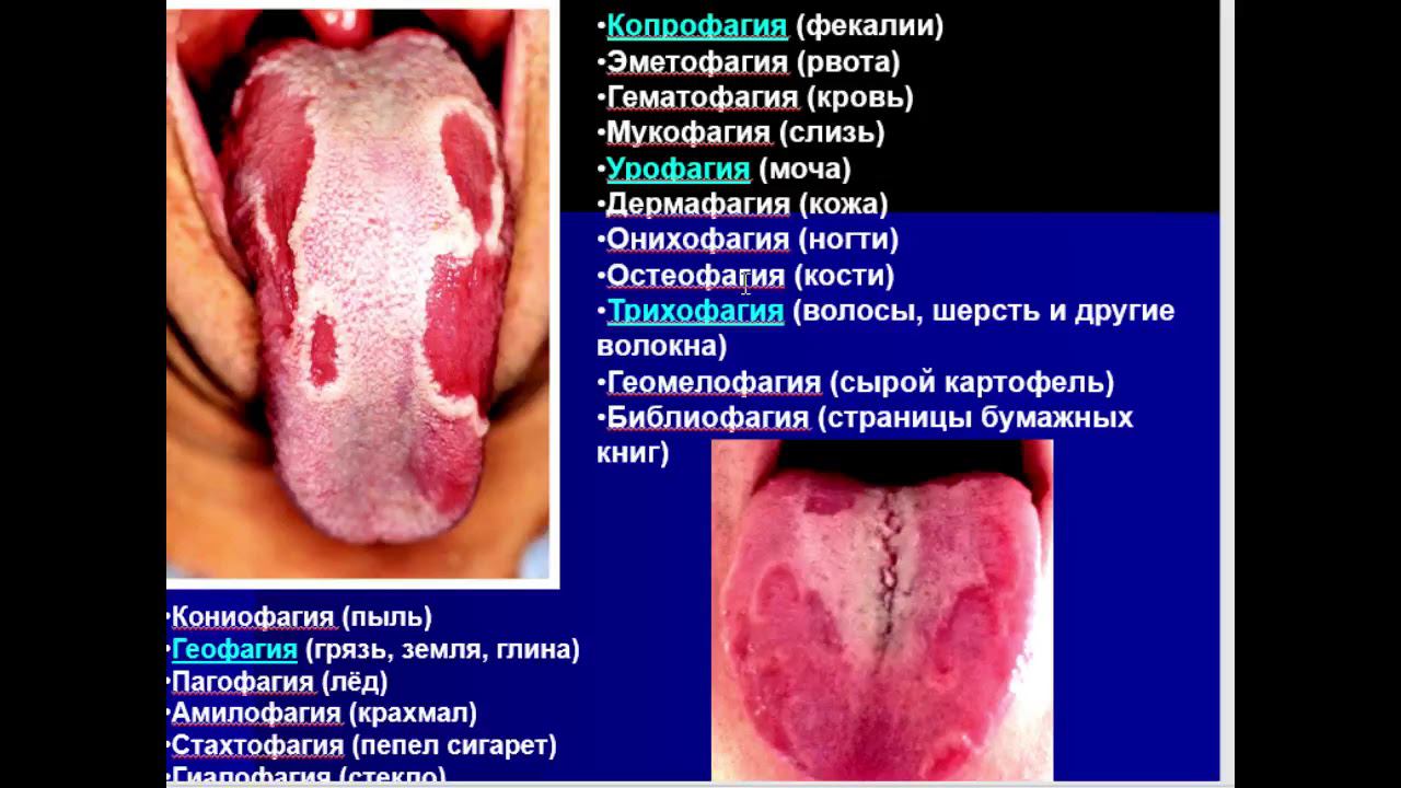 Патофизиология пищеварения - заключение