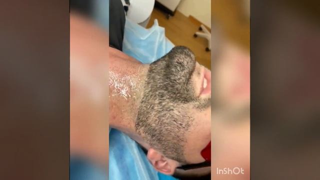 элос эпиляция волос, убираем с шеи, затылка смотреть онлайн