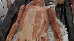 Мышцы живота и паховый канал на трупе