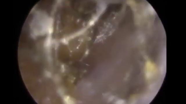 Прокол ушей и уход за ними