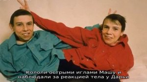 Тяжёлая судьба советских сиамских близнецов Кривошляповых – Маши и Даши
