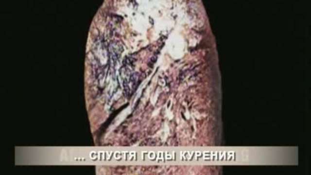 Брось курить, сохрани себя и окружающих