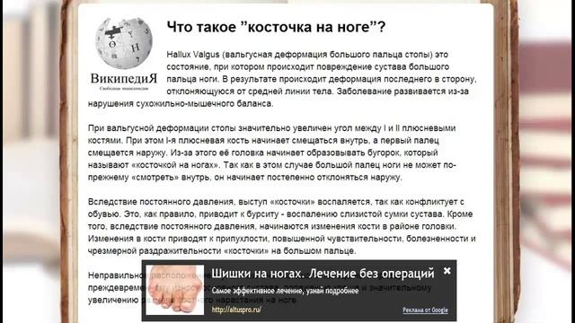 сбоку на ноге растет косточка \ подагра причины возникновения