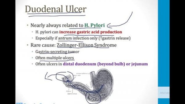 Gastroenterology - 3. Clinical Gastroenterology - 8.Gastric Disorders atf