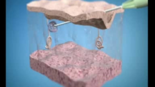 Без грима. Уколы красоты смотреть онлайн