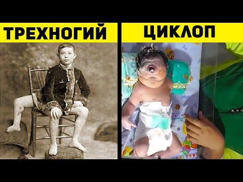 Шокирующие Люди с Необычной Внешностью