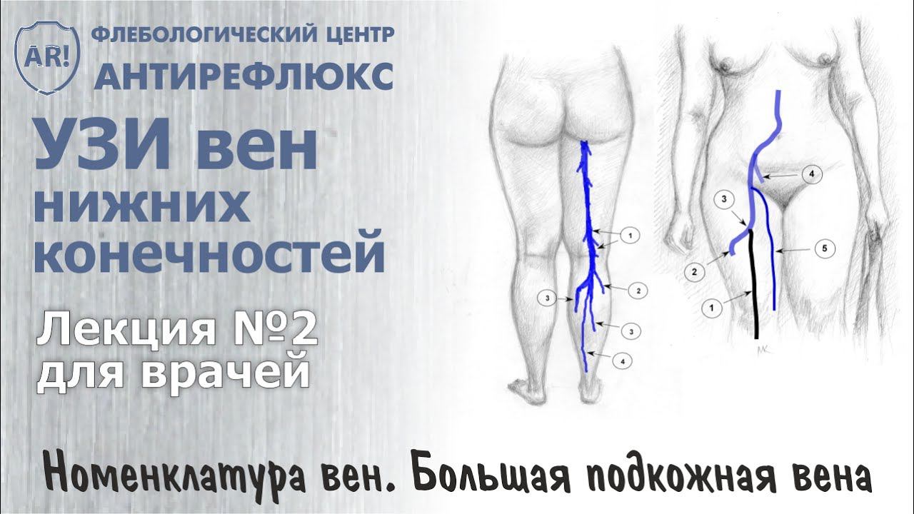 УЗИ вен. Римская номенклатура. Большая подкожная вена смотреть онлайн