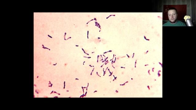 Введение в микробиологию. Часть 8. Систематика. Стафилококки. G- кокки. Пропионовые. Археи смотреть онлайн