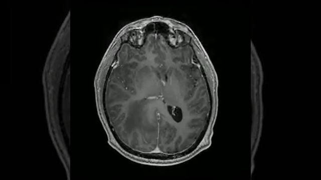 Axial FSPGR BRAVO GD+ 12 1 смотреть онлайн