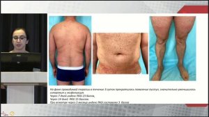 МОСКОВСКАЯ ОБЛАСТНАЯ НАУЧНО-ПРАКТИЧЕСКАЯ КОНФЕРЕНЦИЯ«ПРОГРЕСС РЕВМАТОЛОГИИ В 2021 Г.»