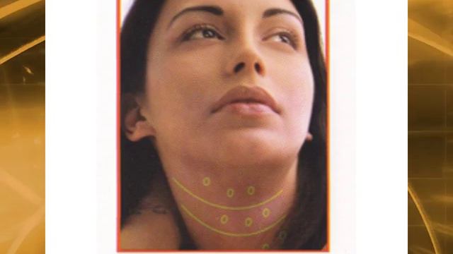 Клиника молодости "Лето" смотреть онлайн