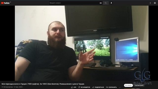Краткая история создания "Географт".Пересадка волос в России по доступным ценам. смотреть онлайн
