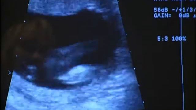 Discovery.Rukovodstvo.dlja.beremennyh.avi