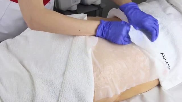 Zabieg Cooltech w Anlaya Day SPA смотреть онлайн