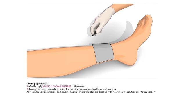 SILVERCEL™ Non-Adherent Hydro-Alginate Antimicrobial Dressing With Silver - How To Use