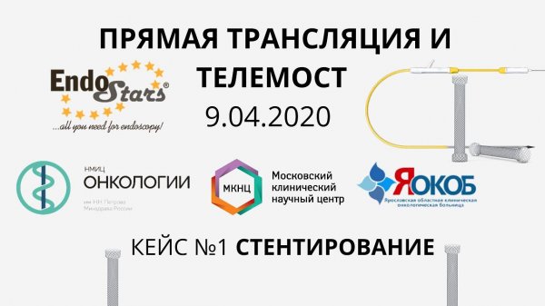Эндоскопическое стентирование. Онлайн трансляция. Эндо Старс (Endo Stars LLC).