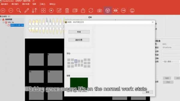 Process of using Handy Digital Dental X ray imaging system HDR-500