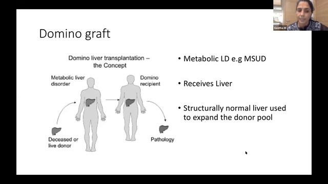 World Liver Day Webinar | April 19 | IAP Thiruvananthapuram смотреть онлайн