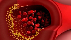 Золотая кровь ,восстановление всех микро и макро элементов крови