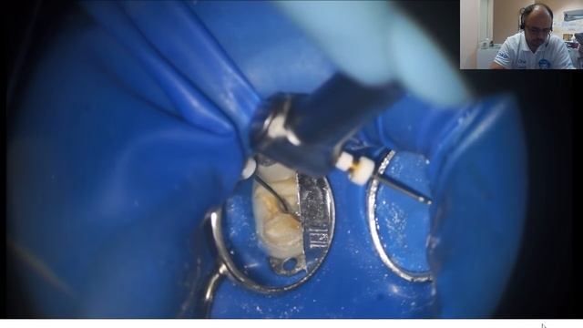 Вебинар на тему возможностей файлов Соко в сложных каналах. смотреть онлайн