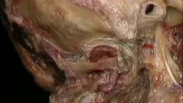 Сосуды головы и шеи. Часть 1. смотреть онлайн