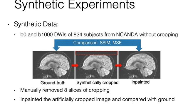 Inpainting Cropped Diffusion MRI using Deep Generative Models смотреть онлайн