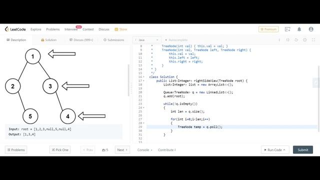 Right View Of Binary Tree | Java | Data Structure & Algorithm | Interview Problem смотреть онлайн