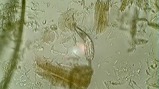 Демодекоз: видео клещ демодекс