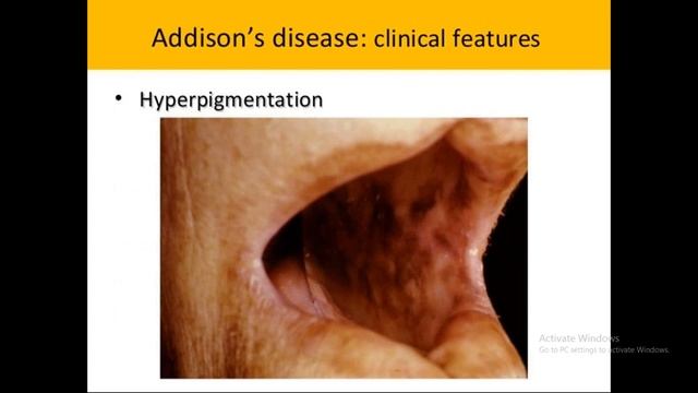 A Class on "AdrenalGland" by Dr SivaPrasad,Bio Chemistry,ASRAM,ELURU. смотреть онлайн
