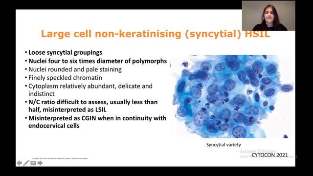 How to report ASCUS, LSIL,HSIL and SCC In PAP screening | cervical cytology part 2 | Bathesda Syste смотреть онлайн