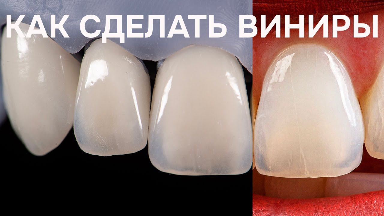 Вебинар для зубных техников Creation LS зубной техник обучение смотреть онлайн